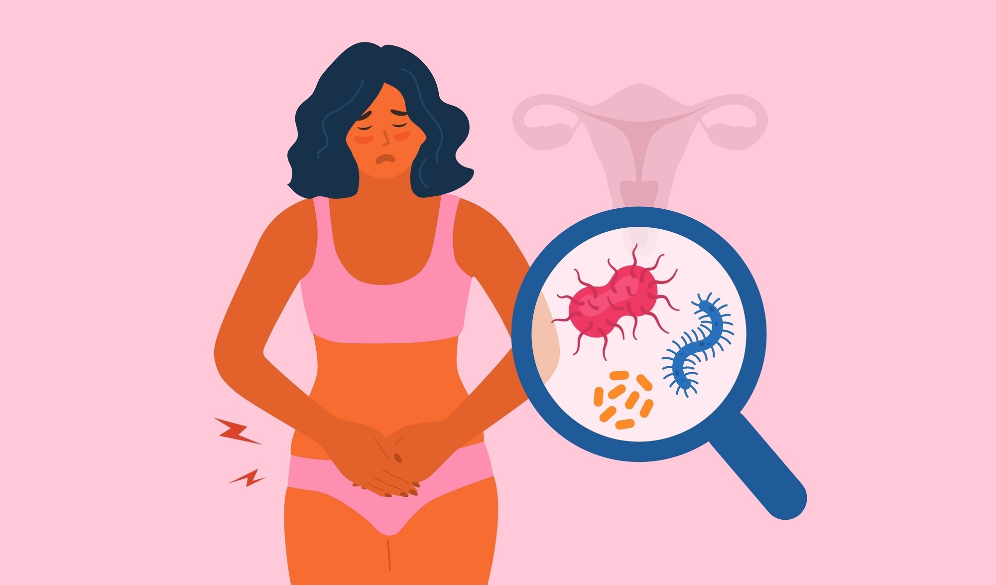 Bacterial vaginosis is a sexually transmitted infection