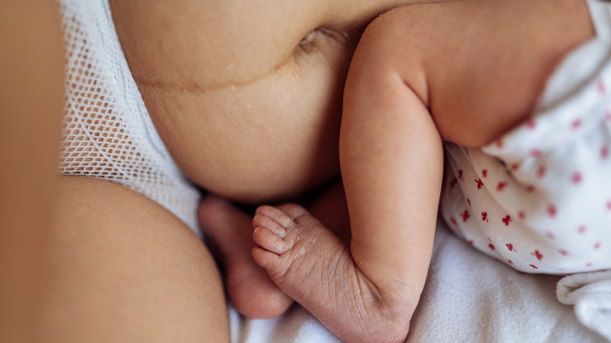 Puerperio: what to expect after childbirth