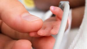 Anencephaly: causes, diagnosis and prevention